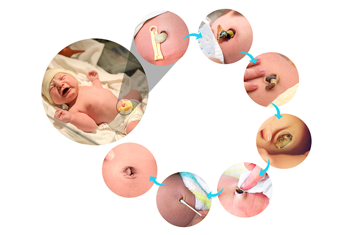 6 Essential Tips To Take Care Of Baby's Umbilical Cord