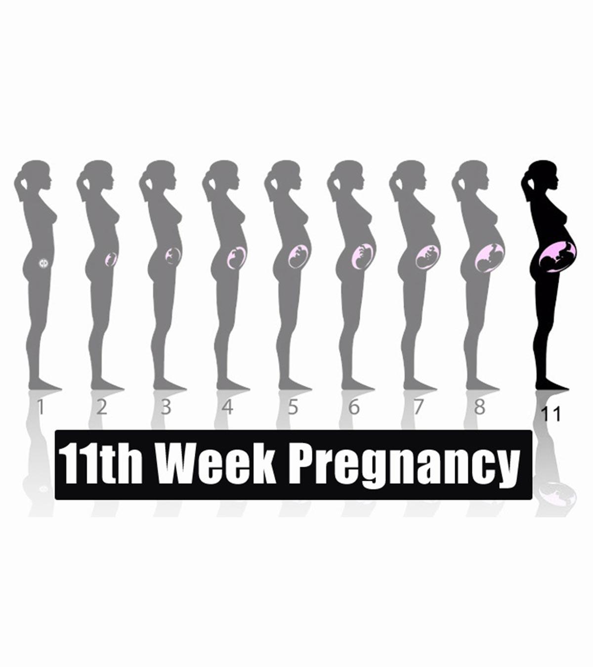 Pregnant Woman Experiencing 11th-week Symptoms