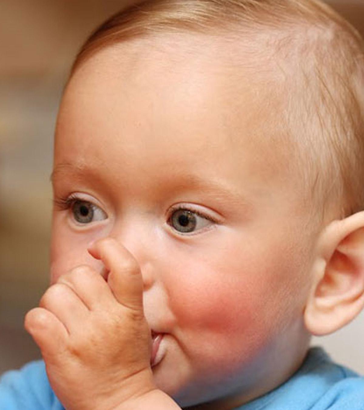 Baby With The Habit Of Thumbsucking