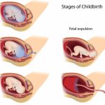3 Vital Stages Of Labor What Happens In Them And What To Do