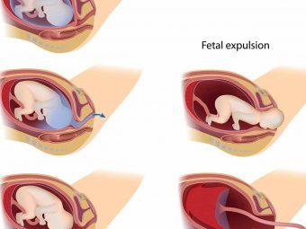 3 Vital Stages Of Labor What Happens In Them And What To Do