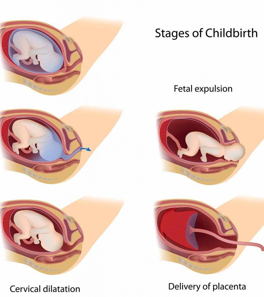 Stages of labor and delivery