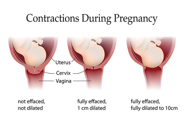 throbbing sensation in vagina labor Lesbeian sex videos