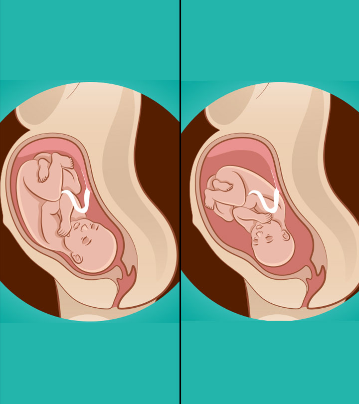 What Are The Best Baby Birth Positions For Comfortable Delivery?