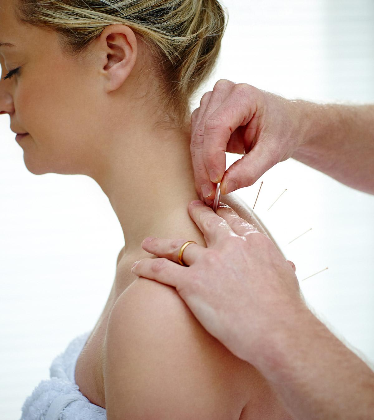 A pregnant lady getting acupuncture treatment