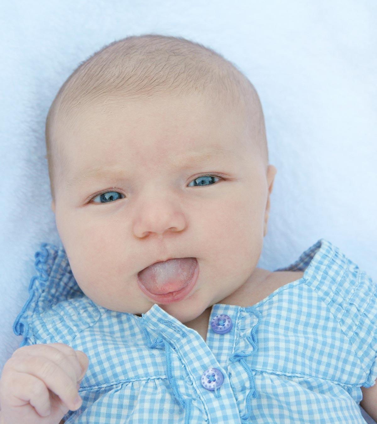 Baby having oral thrush