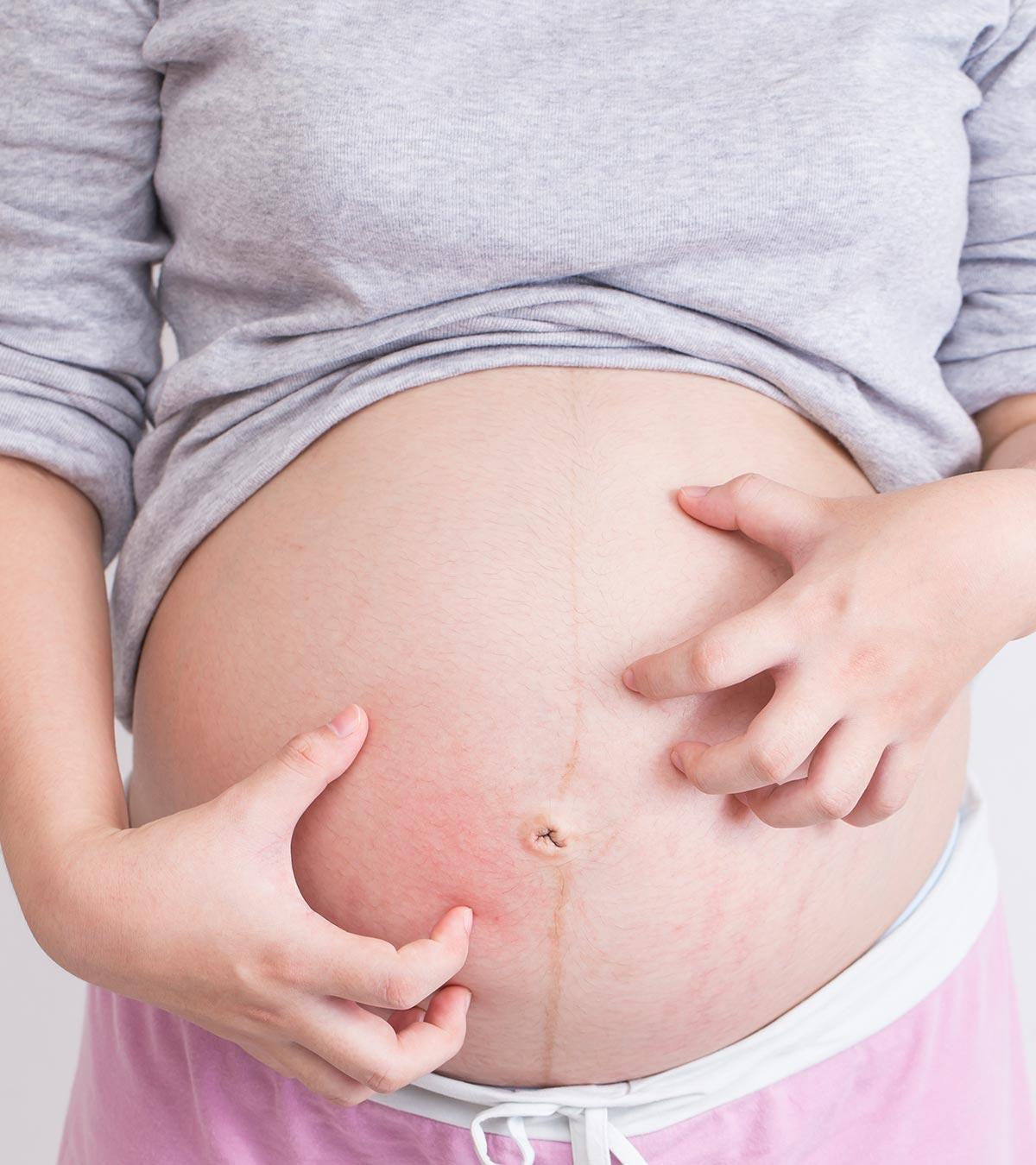 Itching Belly During Pregnancy