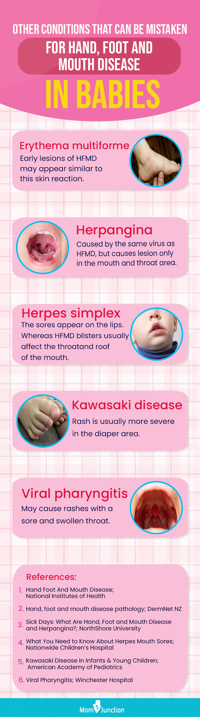 What is hand, foot and mouth disease?