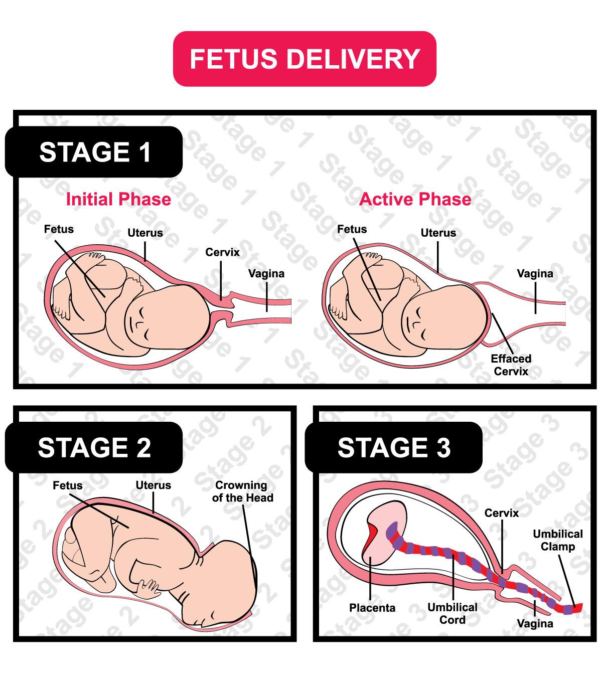 Fetus delivery diagram