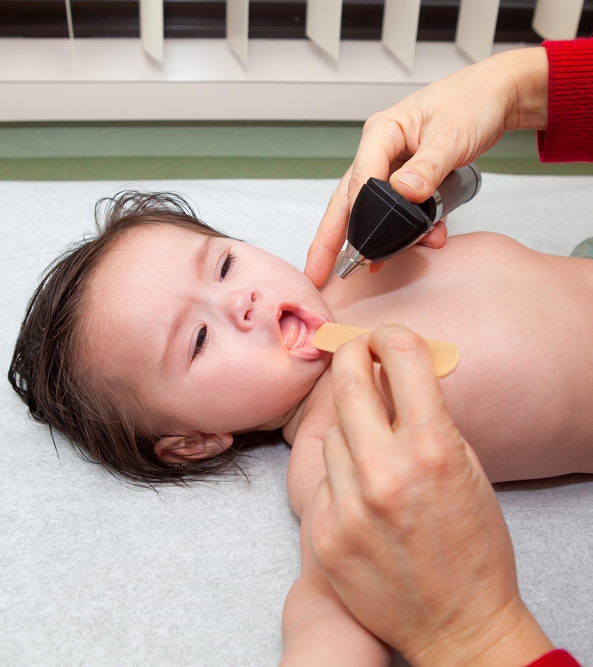 A Baby Suffering From Tuberculosis