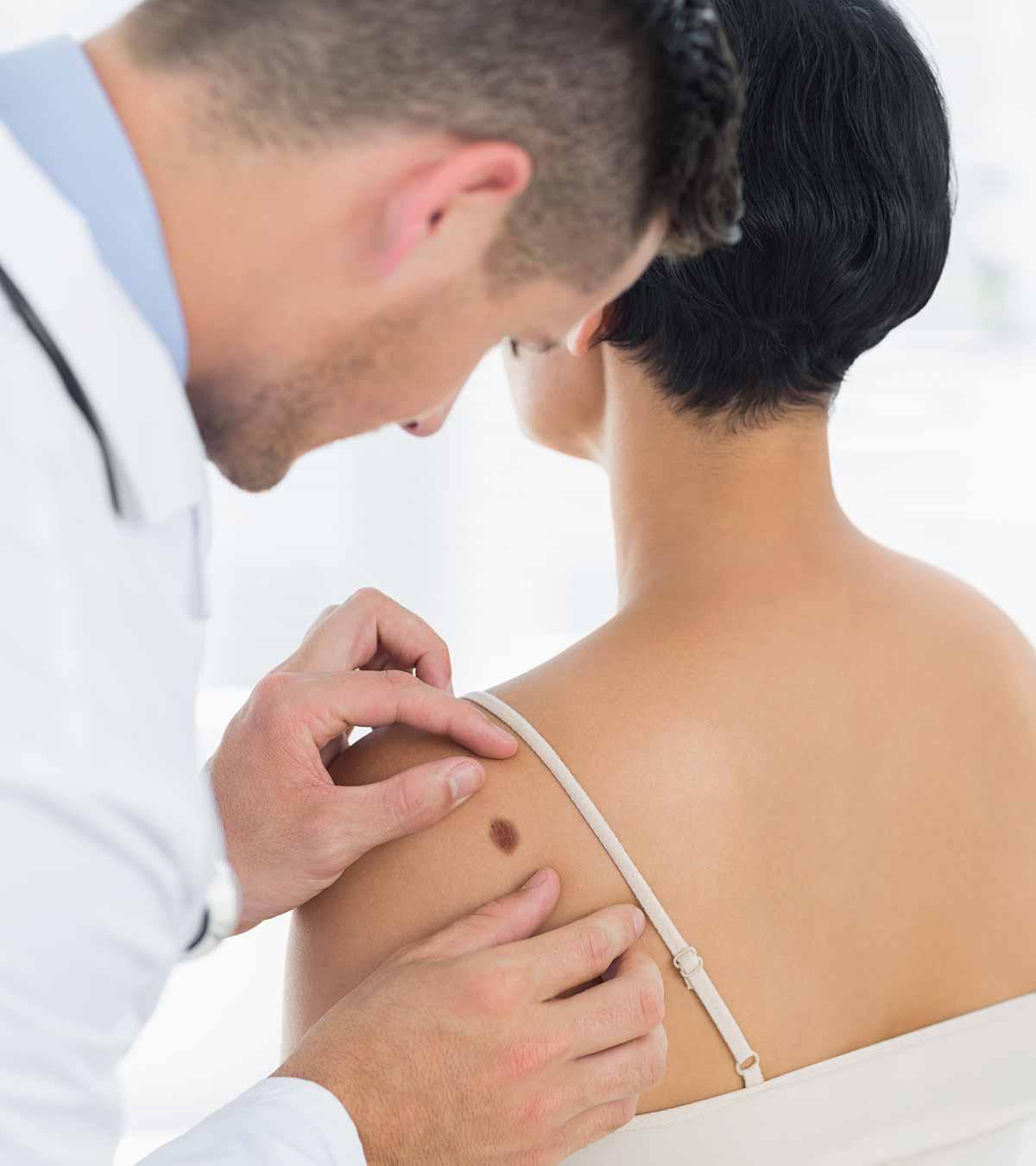 Causes Of Moles Developing During Pregnancy