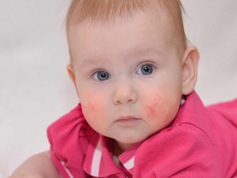 Food Allergies In Babies Causes, Symptoms And Treatment