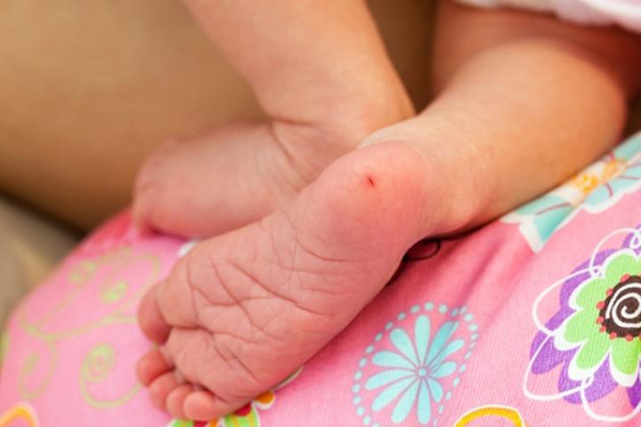 Blood test can diagnose food allergies