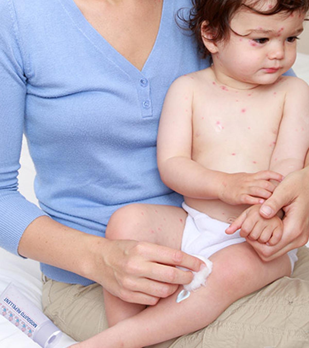 mosquito repellent for babies