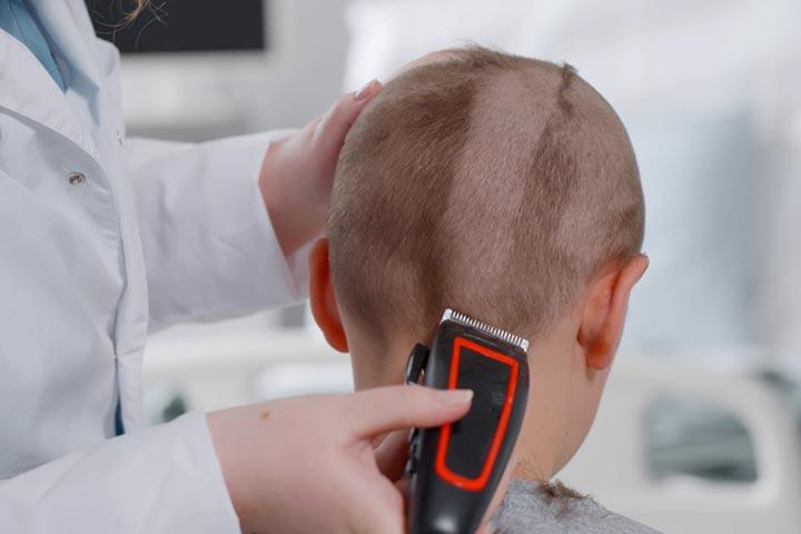 5 Serious Causes Of Hair Loss In Toddlers 5 Serious Causes Of Hair Loss In Toddlers