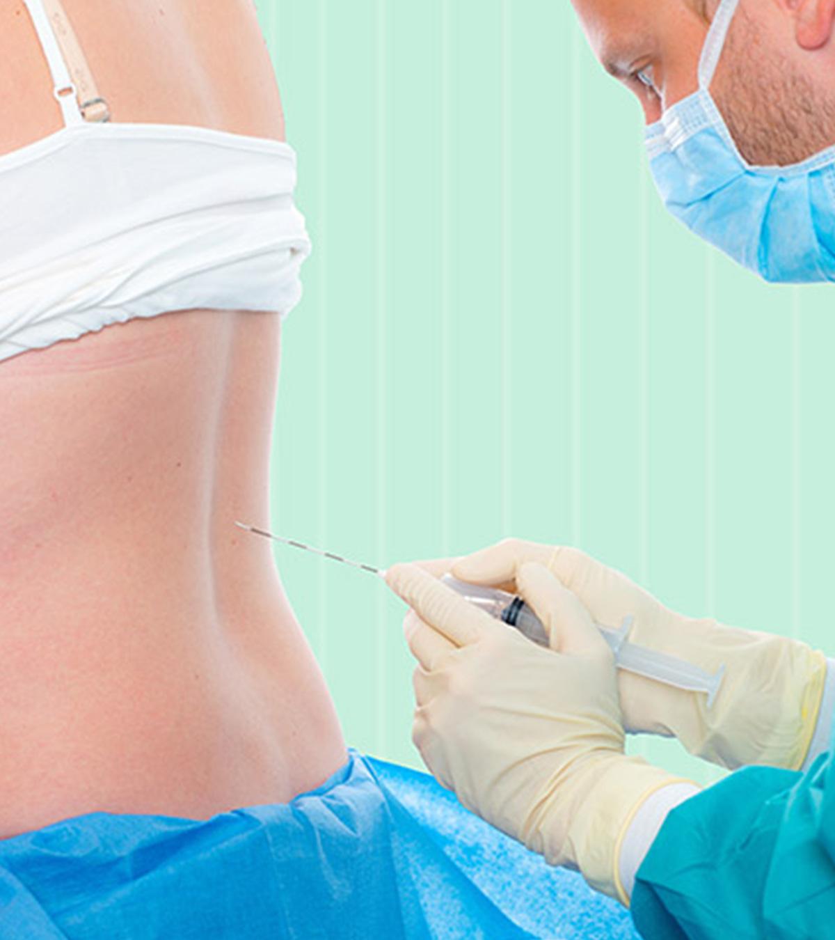 epidural injection