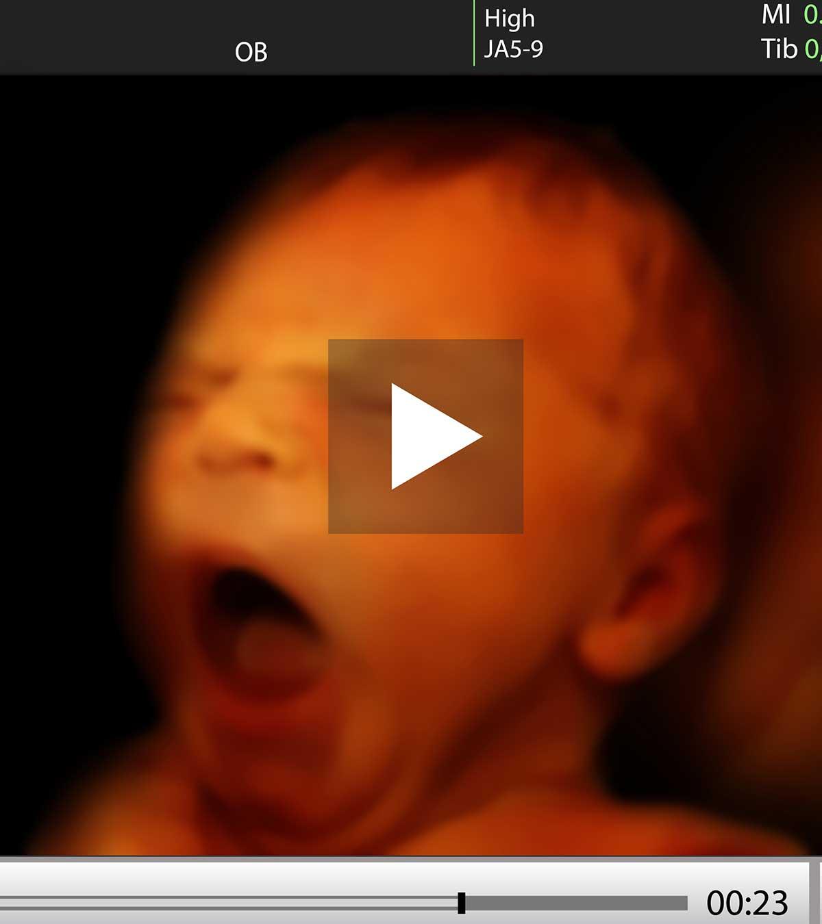 4d Ultrasound Scan Of A Baby