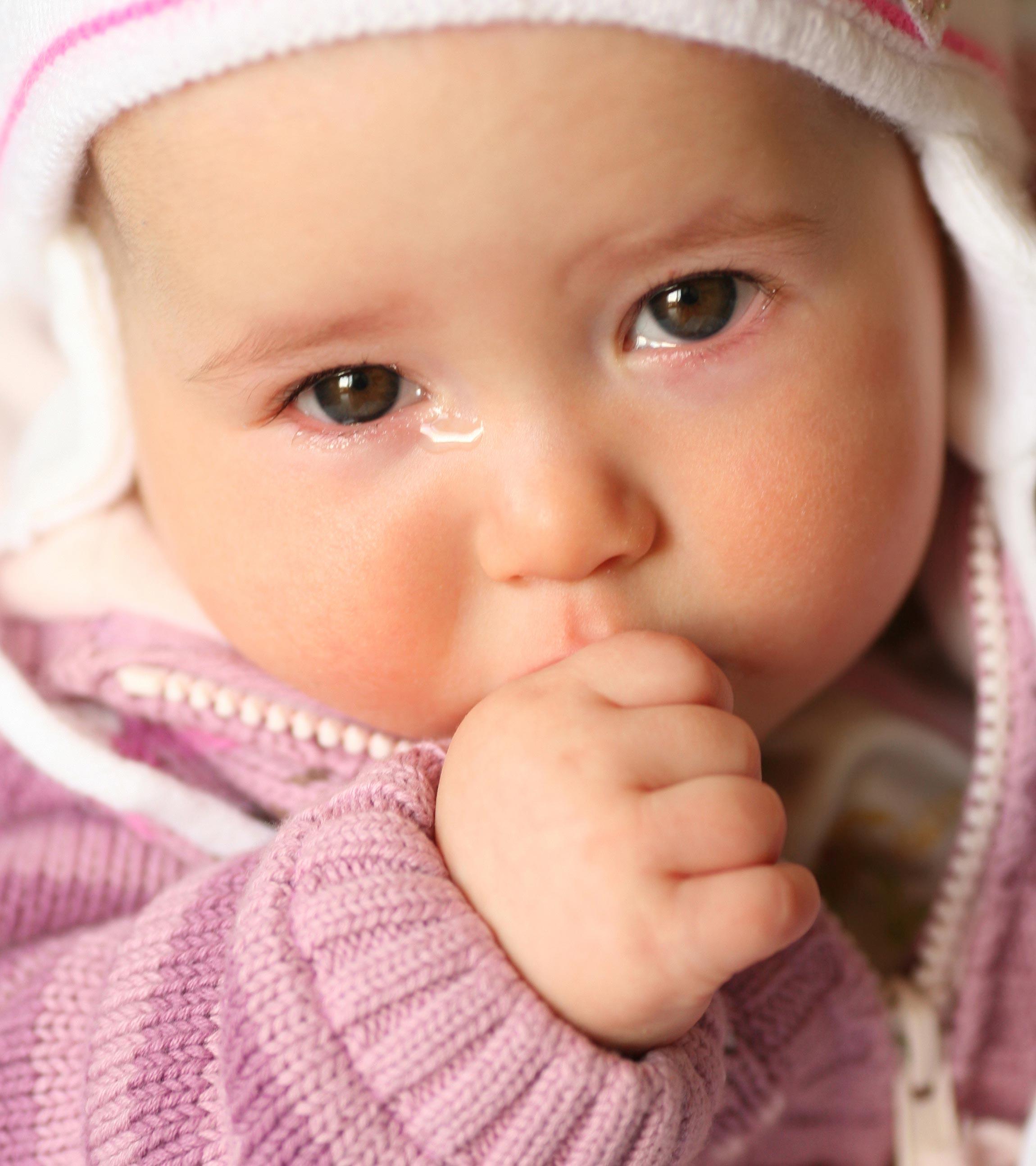 Baby Suffering From Watery Eyes