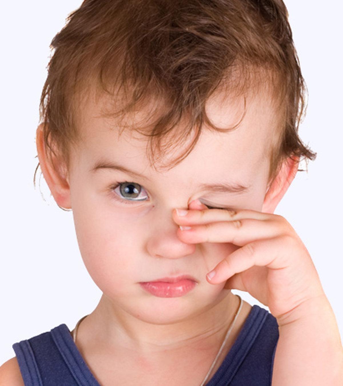 Child With Watery Eyes