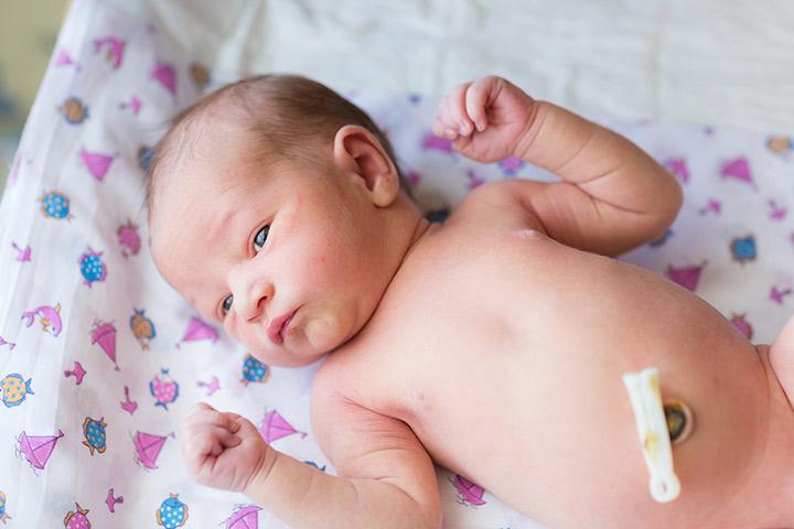 why does your newborn have an outie belly button