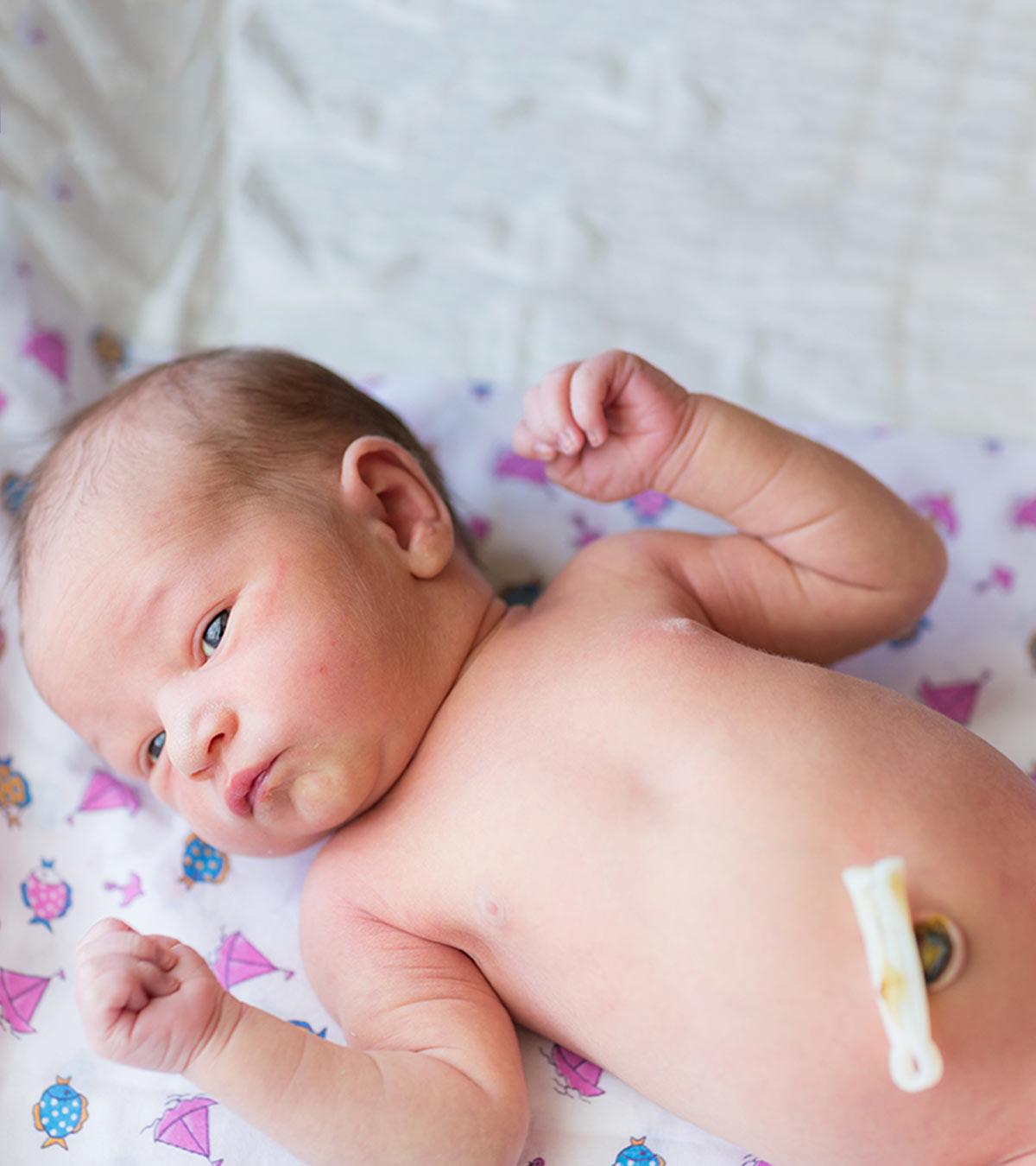 Outie Belly Button In Newborns: Causes, Symptoms & Treatment