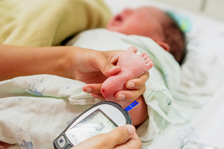 Congenital diabetes may lead to thrush in babies