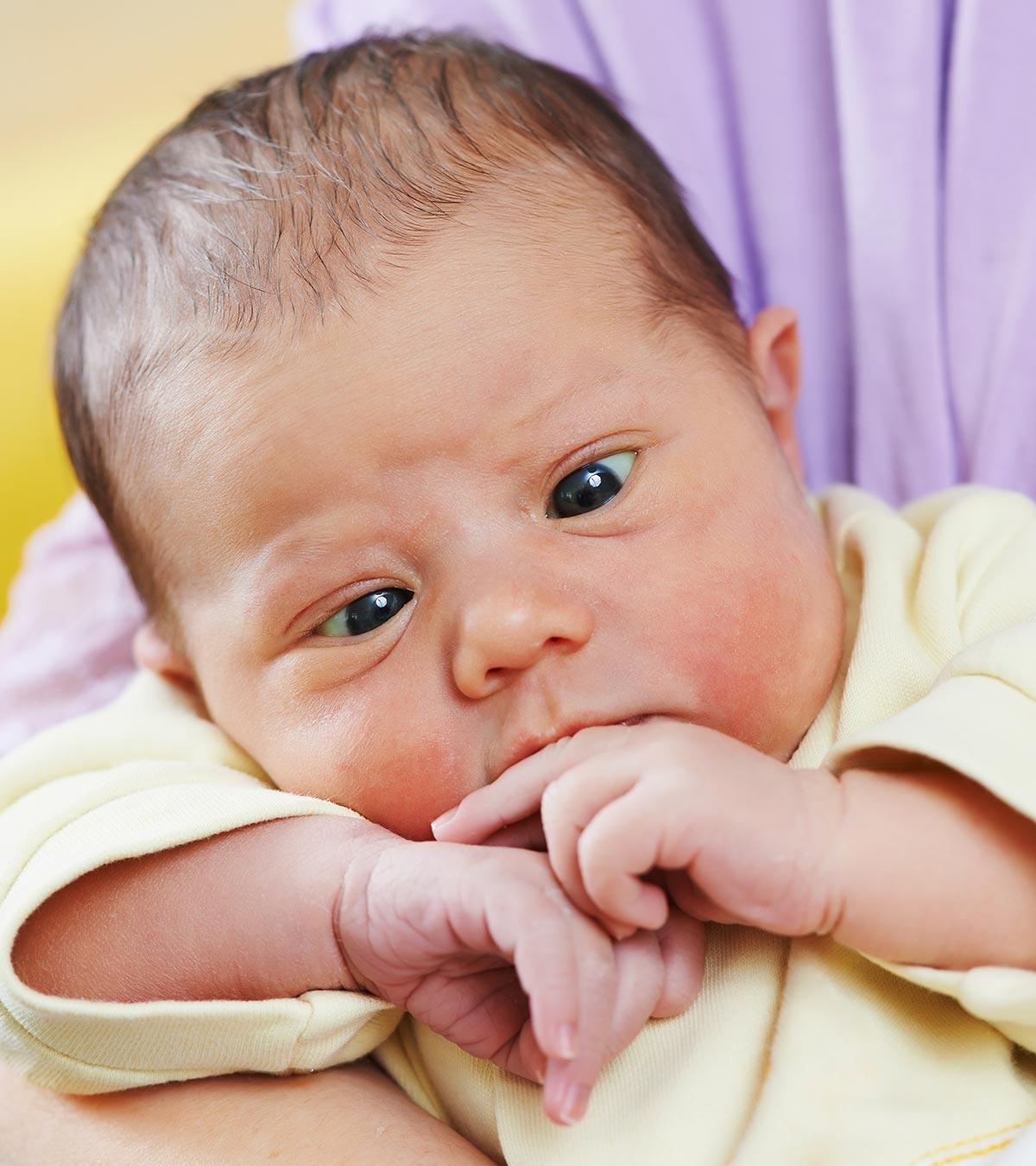 A Baby With Strabismus