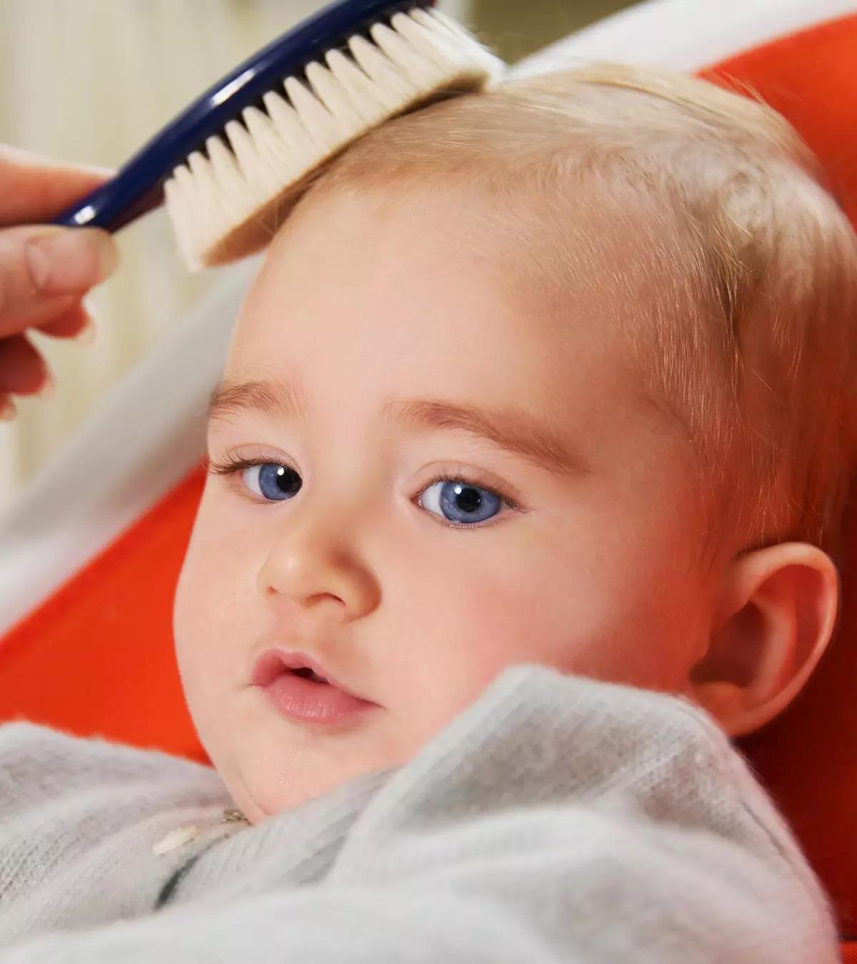 diffuse alopecia areata in child