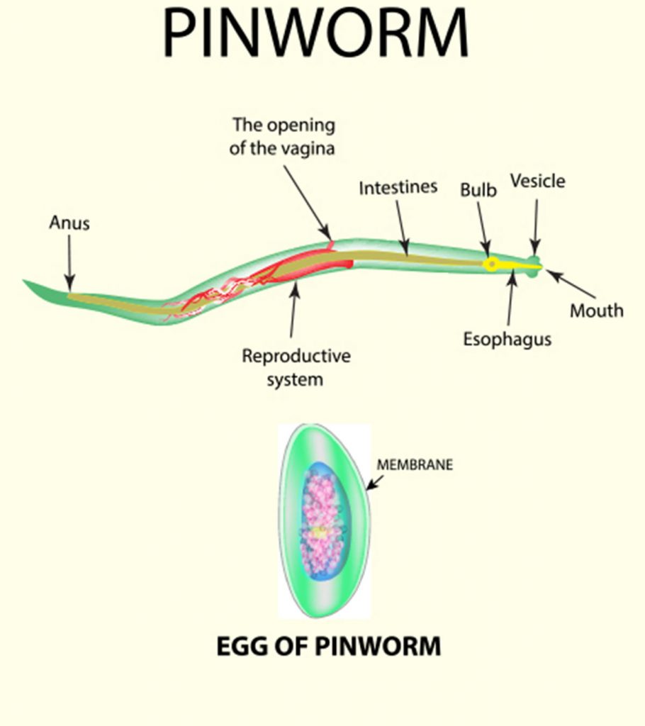 Pinworm- betegség, amelyet pinworms okoz. Pinworm szövődmények
