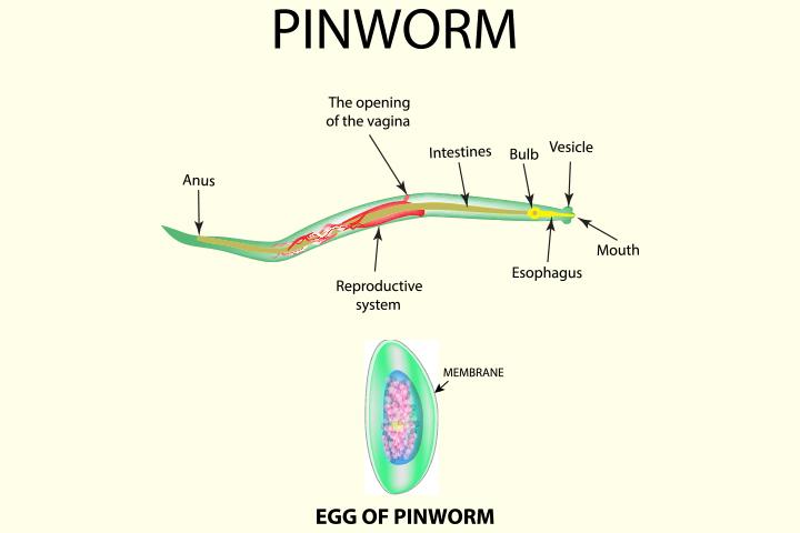 pinworm gyomor