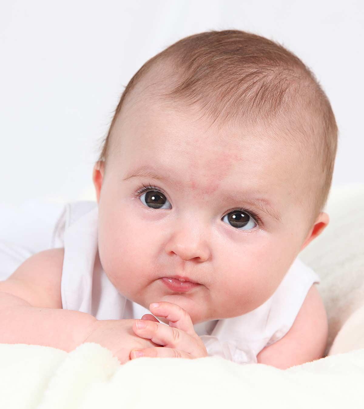 Causes And Treatments For Birthmarks In Babies
