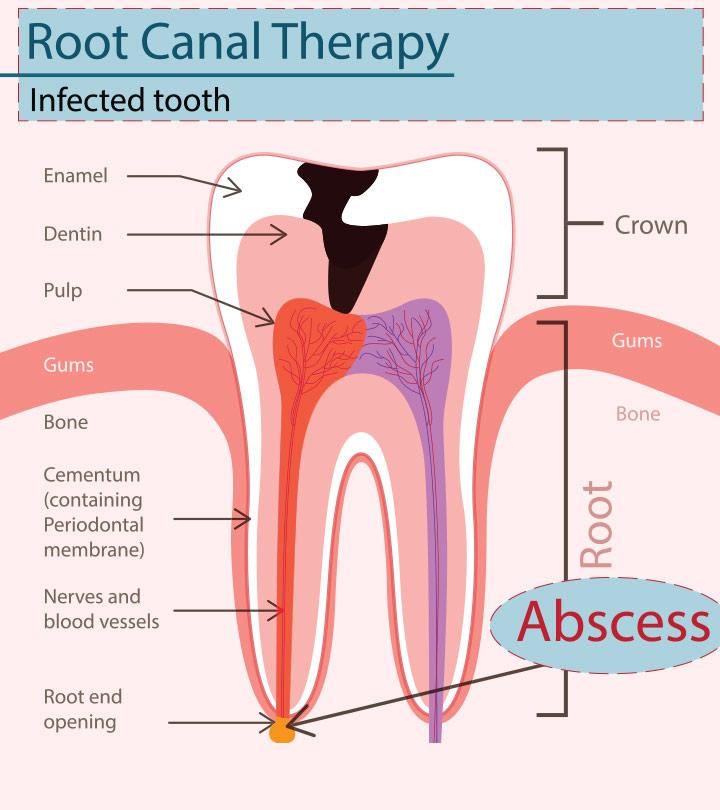 A diagram of teeth