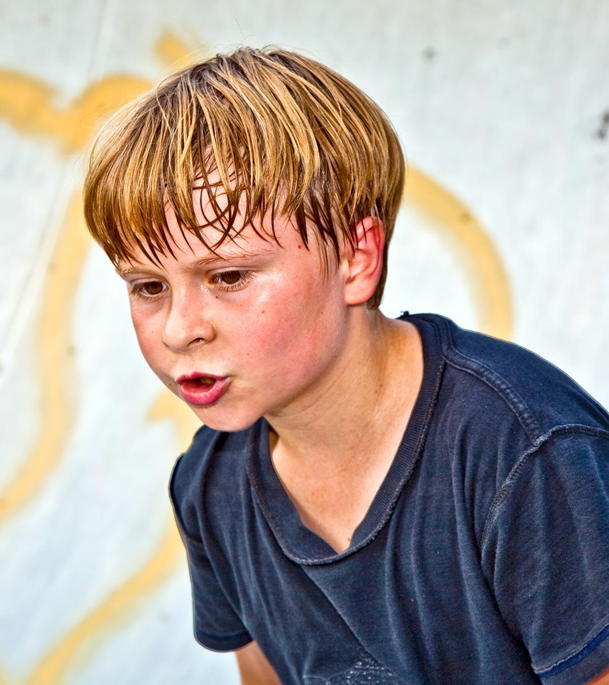Child Suffering With Excessive Sweating