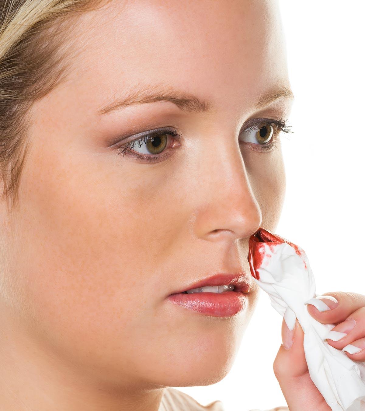 Nosebleeds In Teenagers (Epistaxis): Causes, Treatment And When To See A Doctor