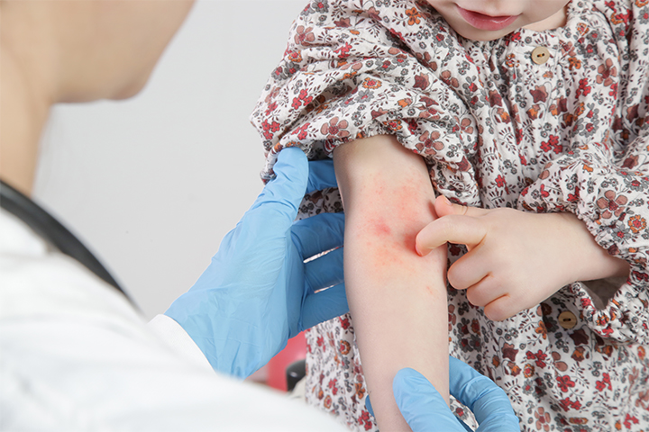Mono In Kids: Causes, Symptoms, Treatment And Prevention