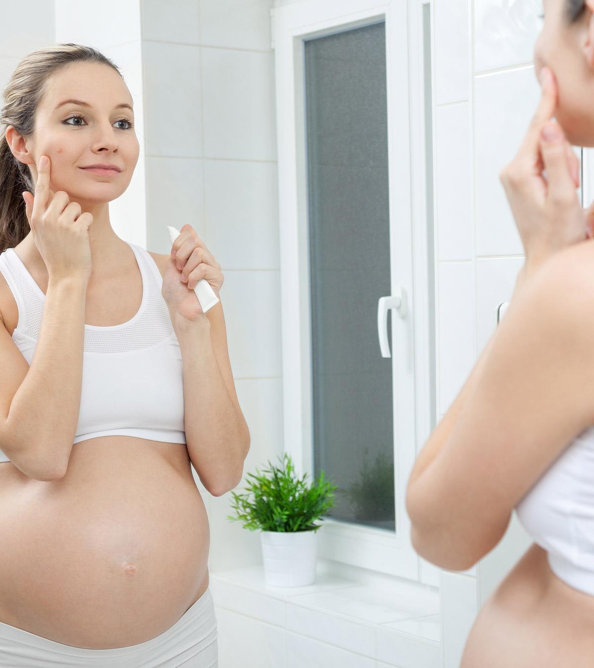 Acne-During-Pregnancy