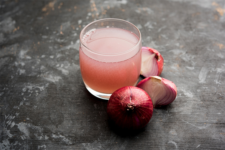Onion juice may help treat a sore throat during pregnancy