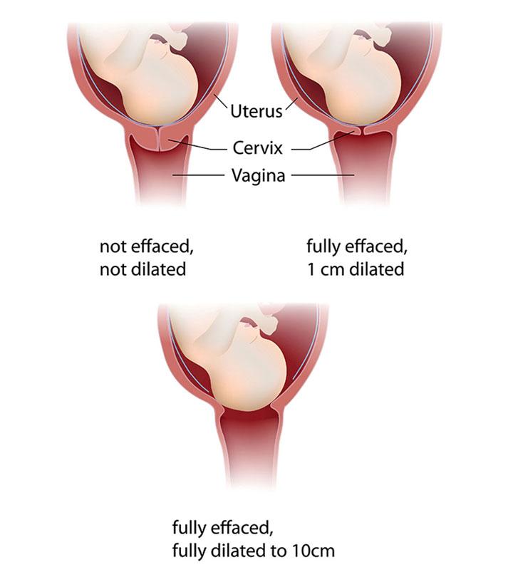 Exercises For Normal Delivery