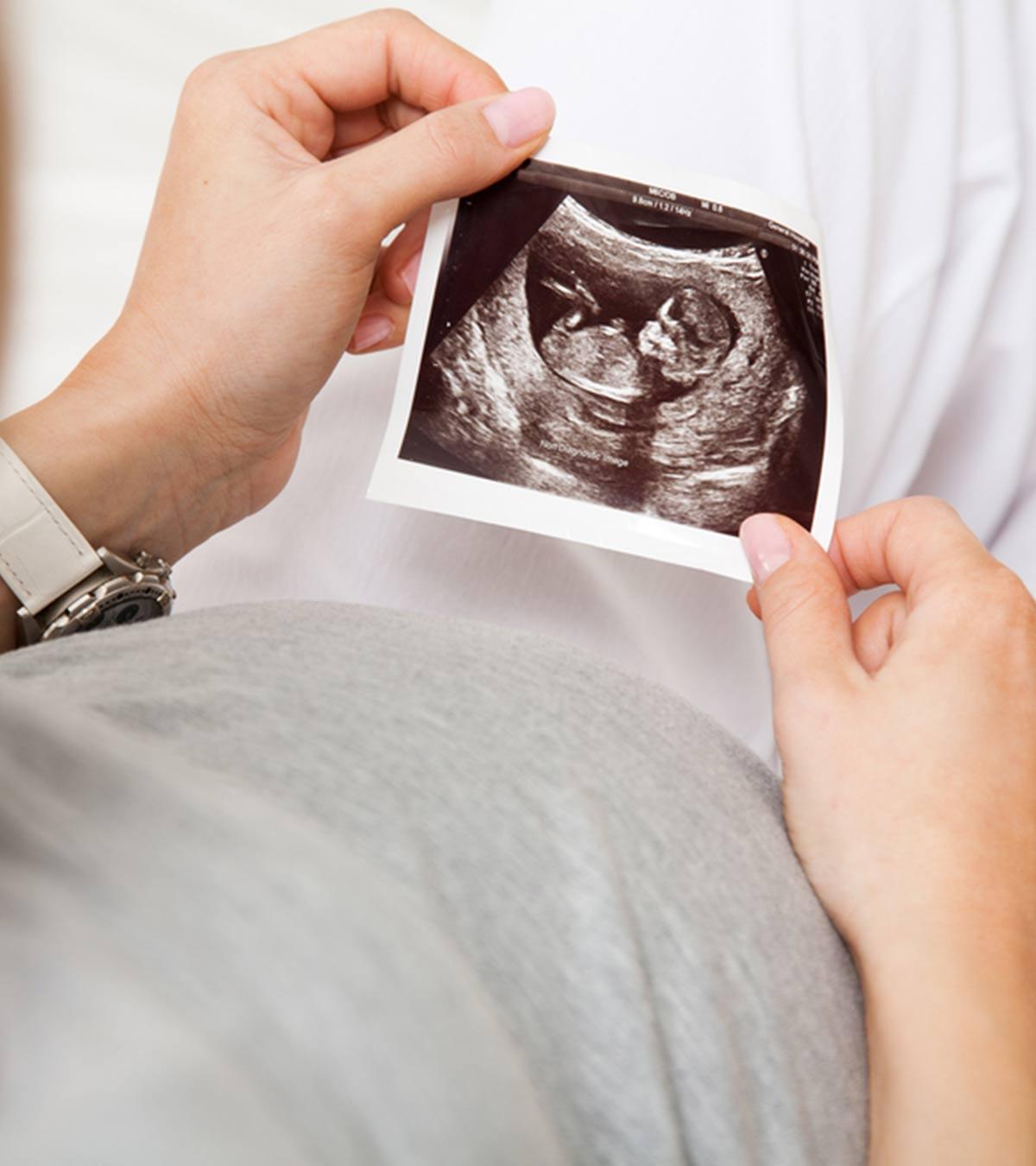 Ultrasound Scan Of A Baby During Pregnancy