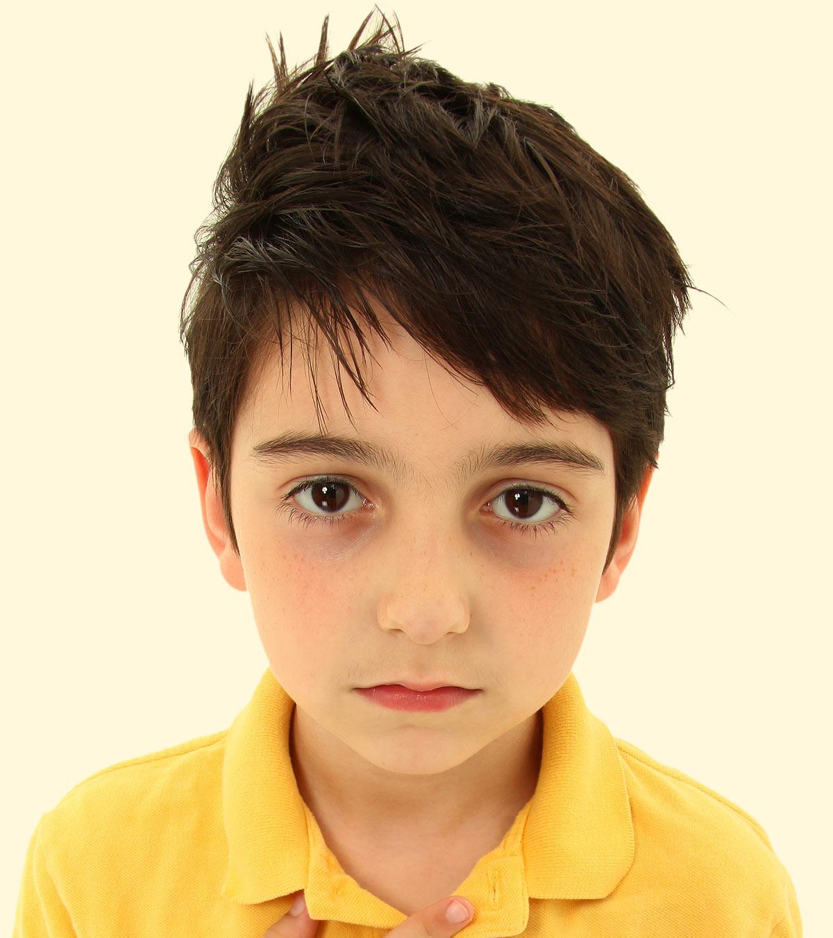 Child with dark circles under eyes