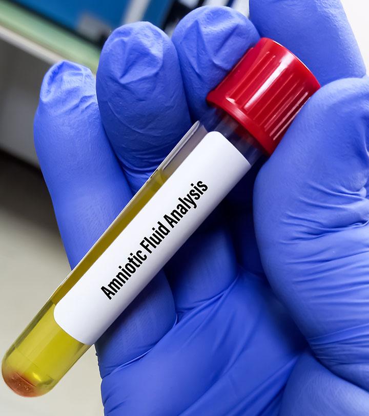 Amniocentesis test