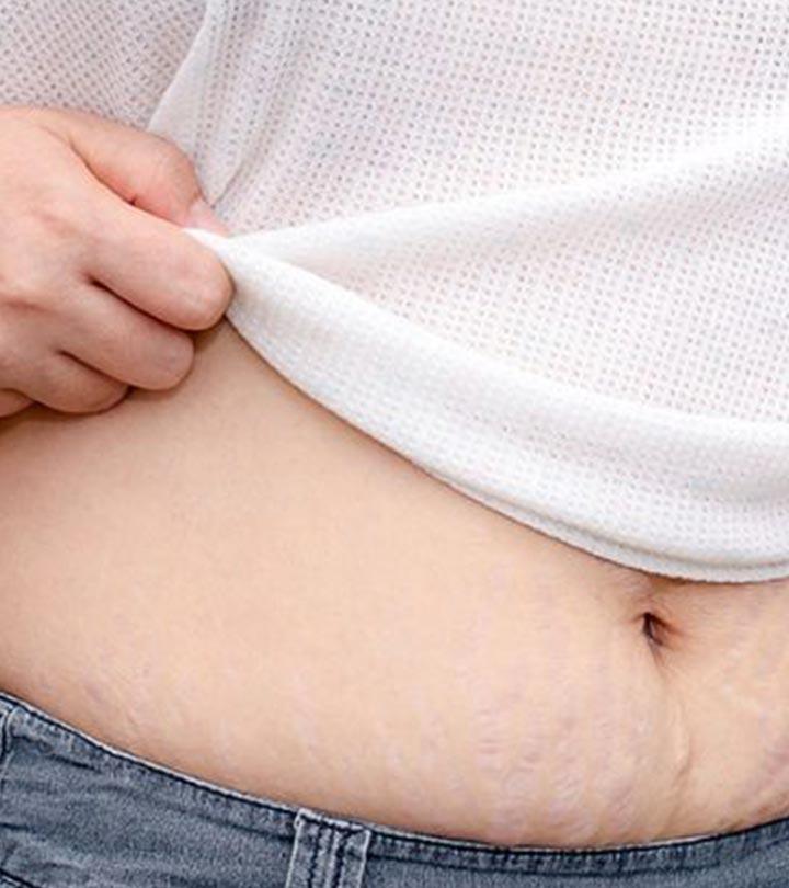 8 Definite Ways To Lose Baby Weight