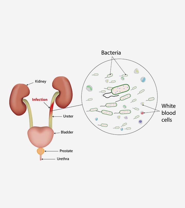 Urinary Tract Infections In Teens: Causes, Risks & Treatment