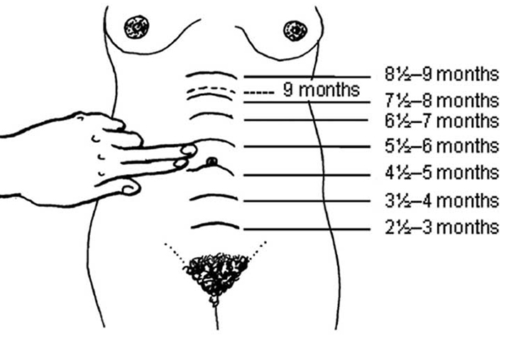 Fundal height measurement using fingers during pregnancy