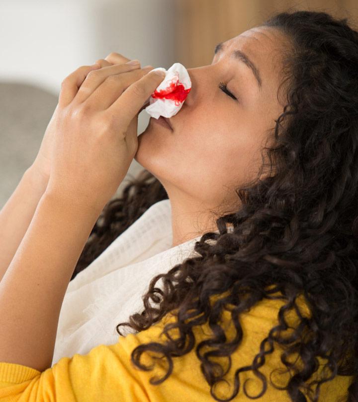 Nosebleeds-In-Teenagers-(Epistaxis)-Causes,-Treatment-And-When-To-See-A-Doctor