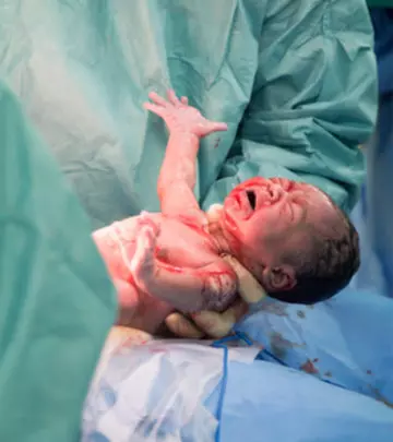 C-Section Deliveries - How They Affect The Newborns