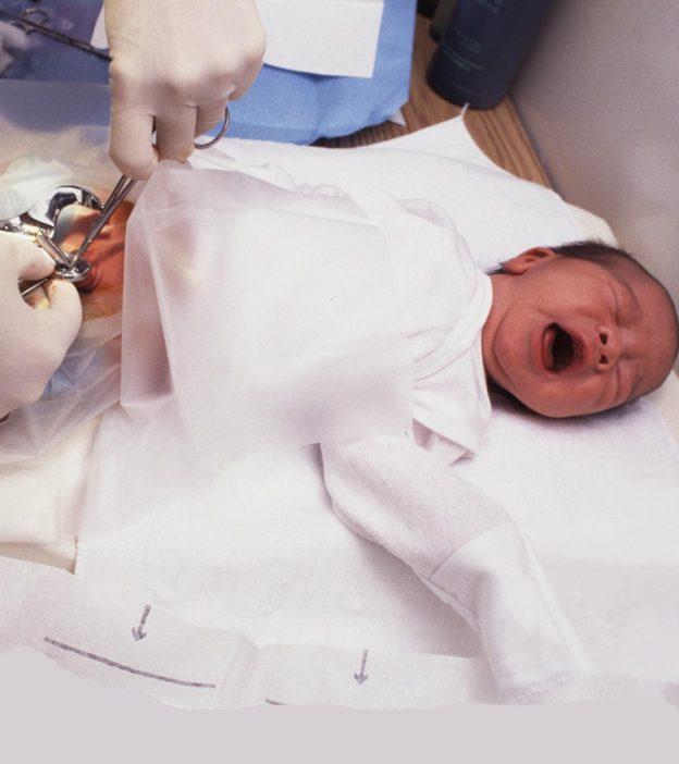 baby circumcision infection