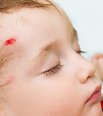10 Signs Of Concussion In Babies, Causes And Treatment