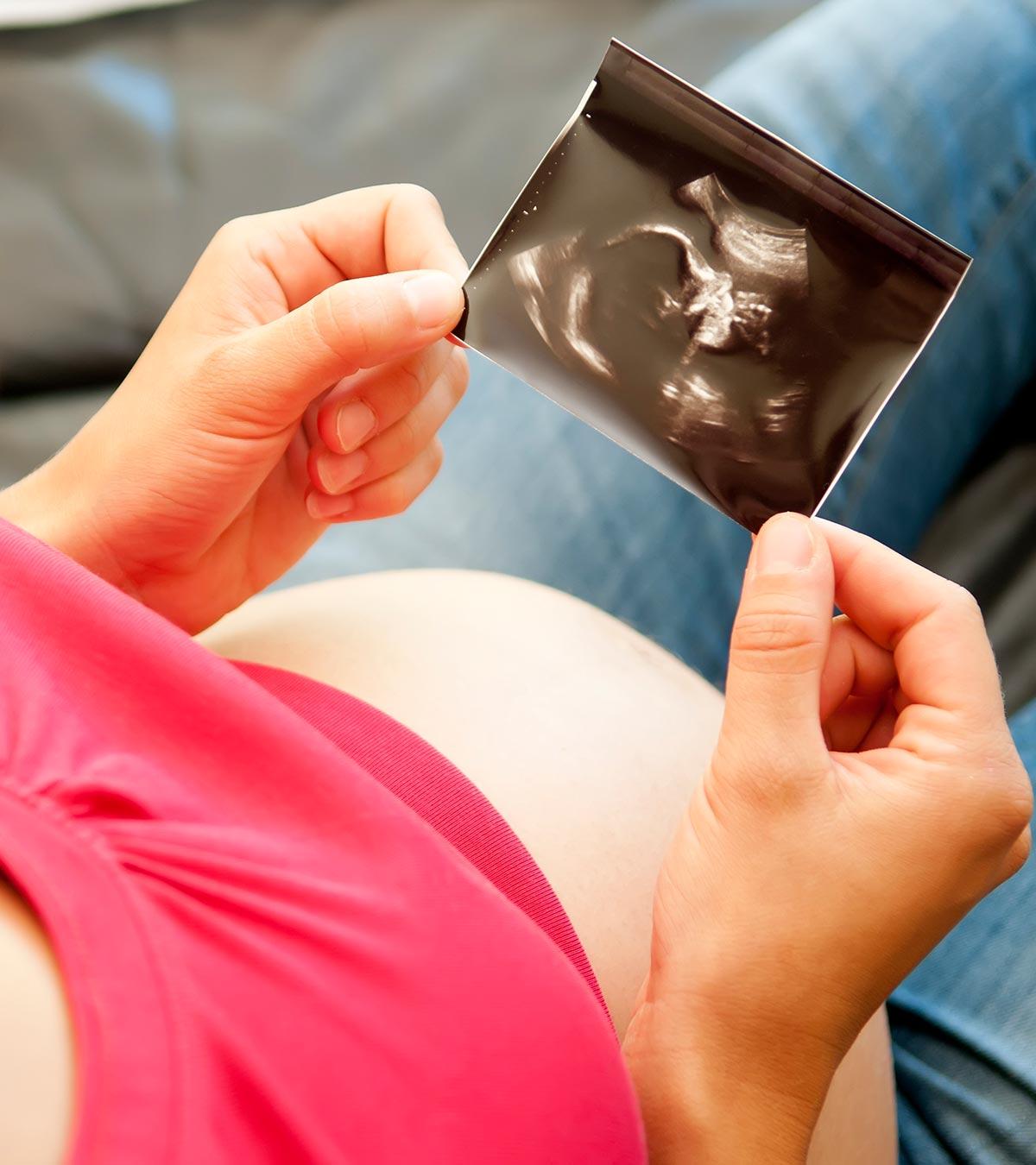 A pregnant lady looking at her sonography