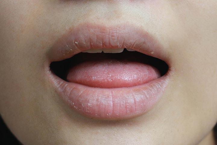 Botox while breastfeeding may lead to a dry mouth